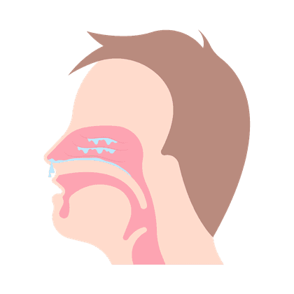 Sinusitis, sinusitis, frontal sinusitis