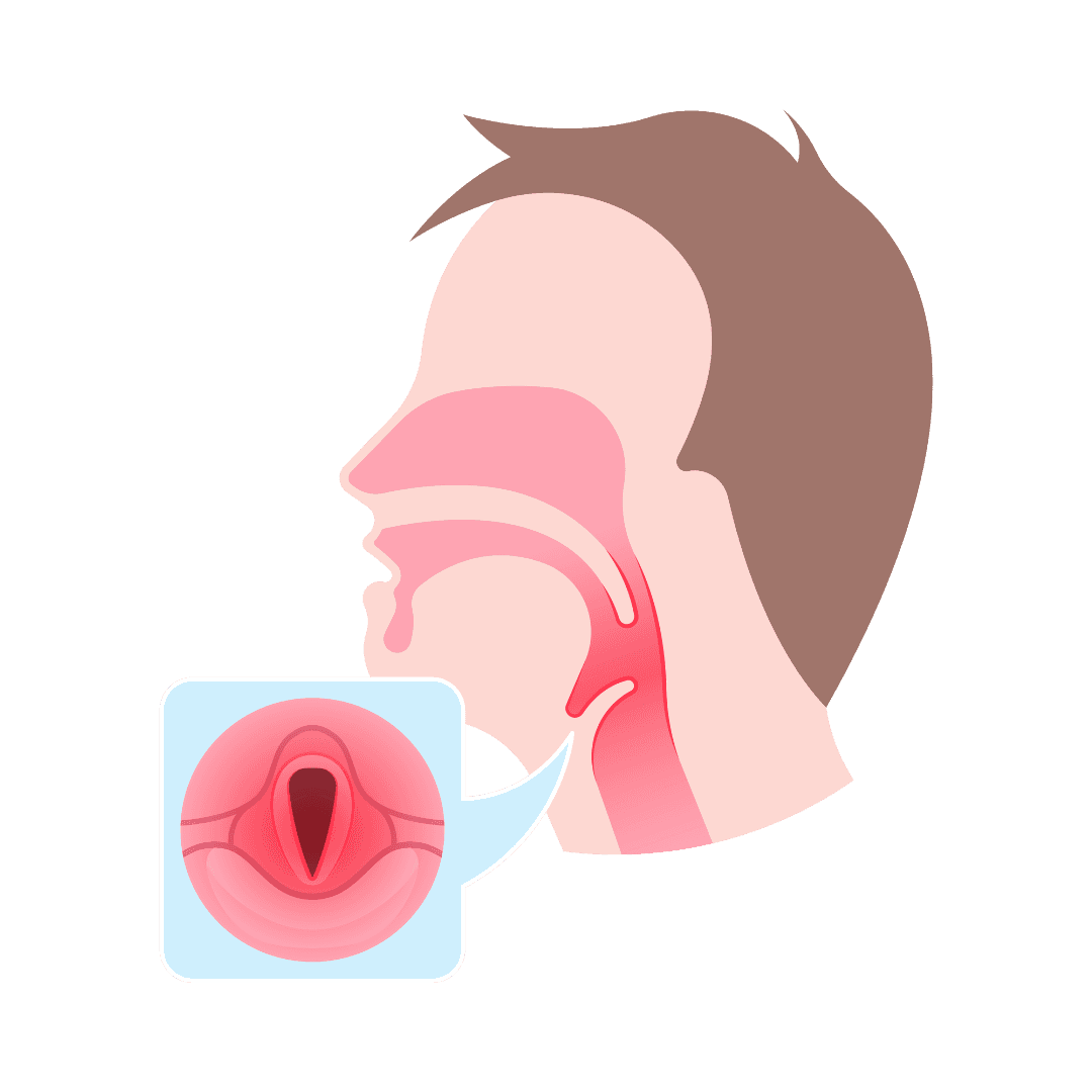 Faringitis
