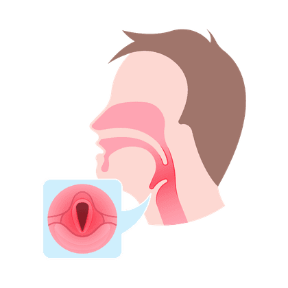 Pharyngitis