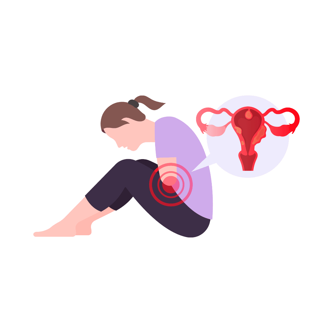 Fibroid uterus