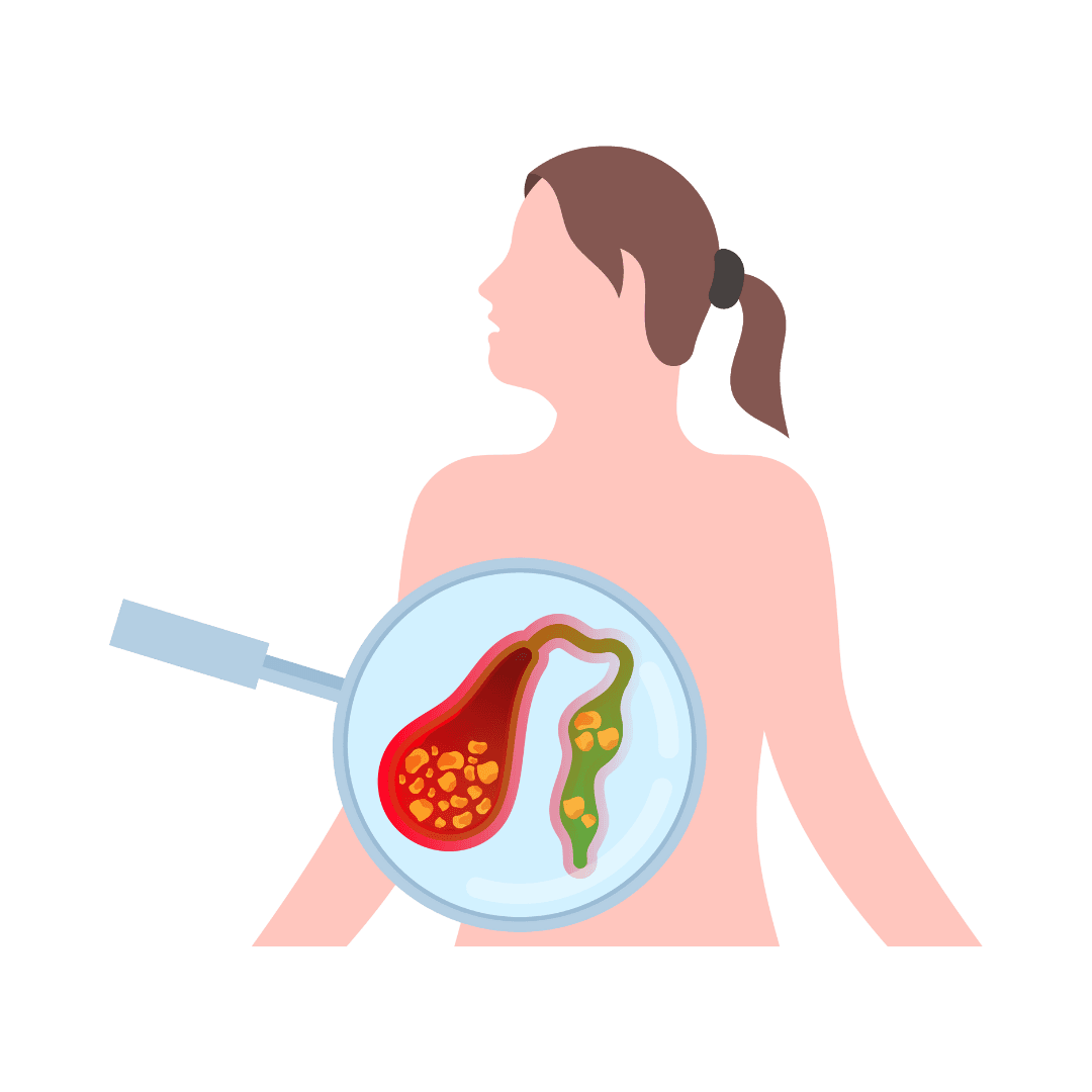 Bile stasis (cholestasis)